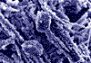 Limescale - amorphous crystals